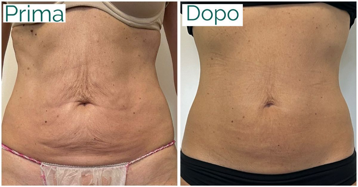 Annalisa Visicchio-2