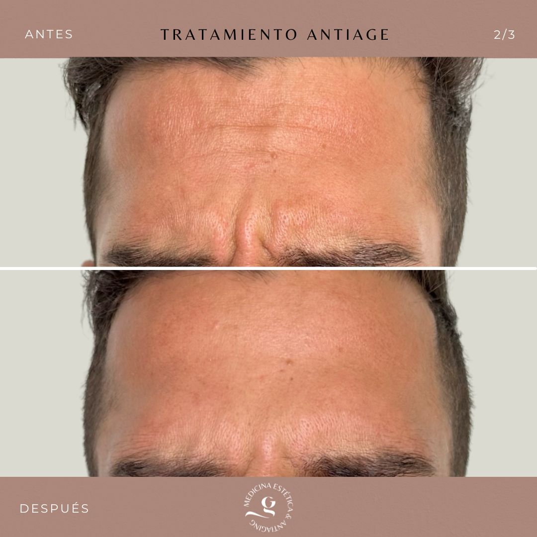 ​Giovanni Giorgianni-5