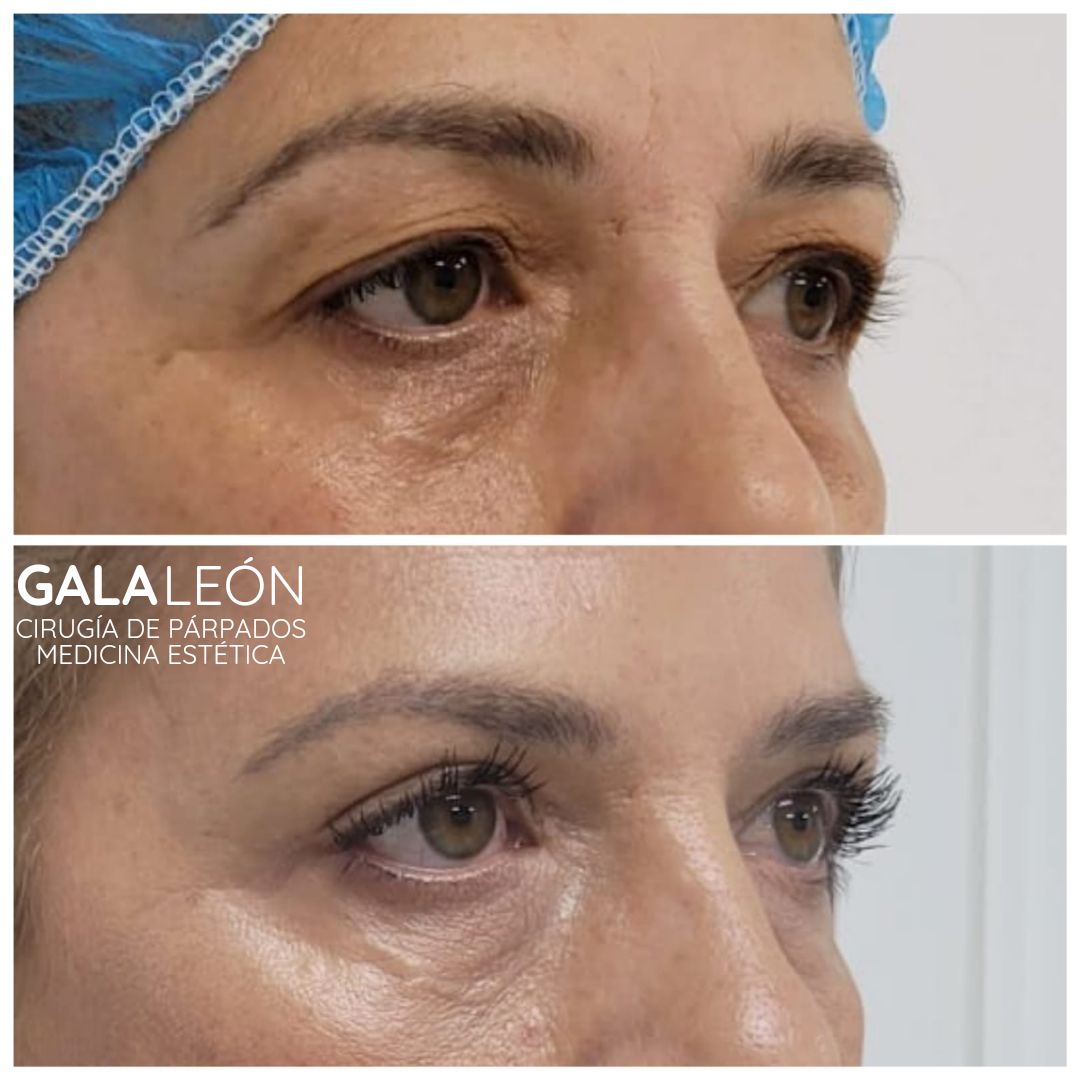 Gala P. Leon Salvatierra-37