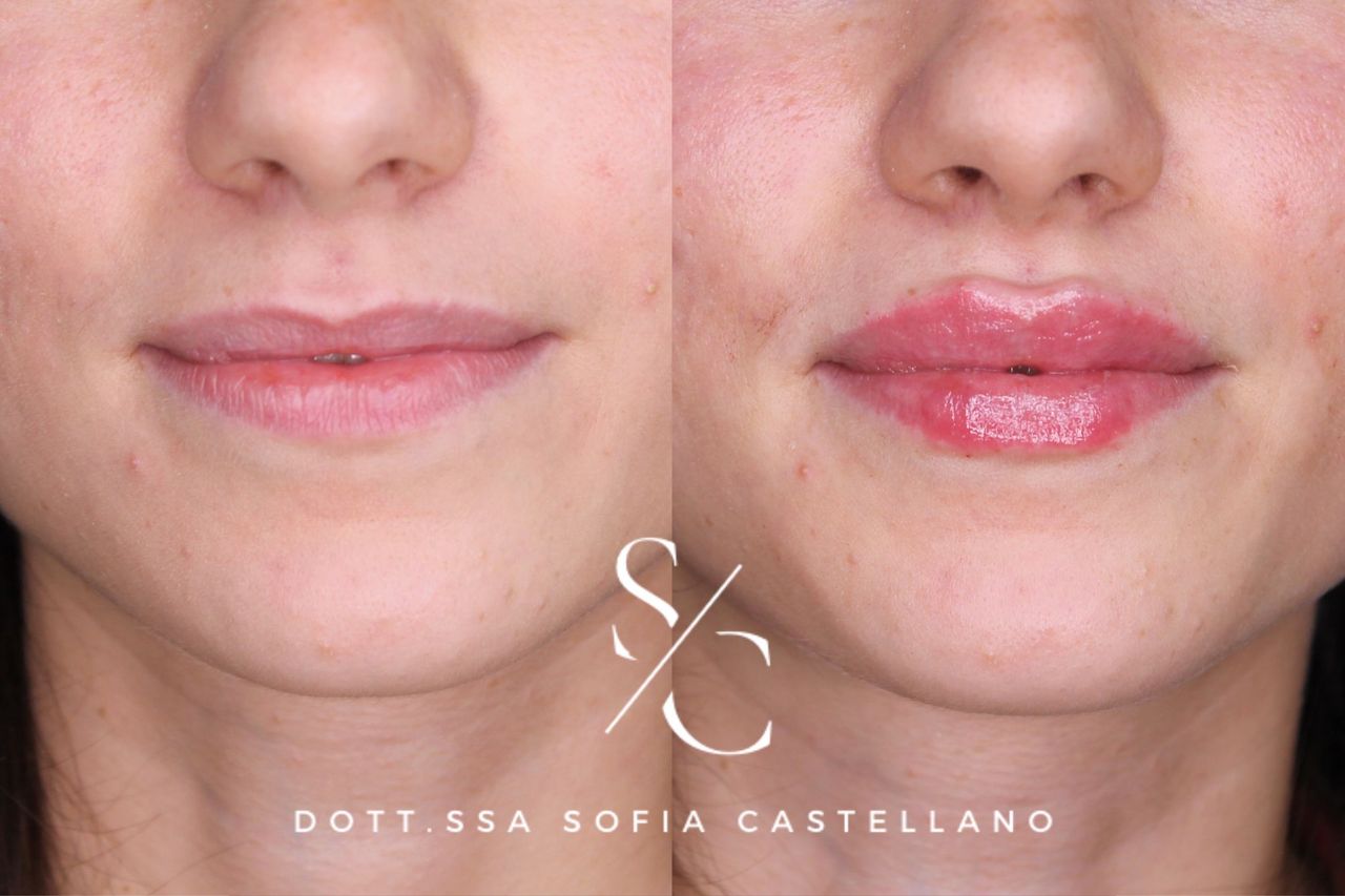 Sofia Castellano-9