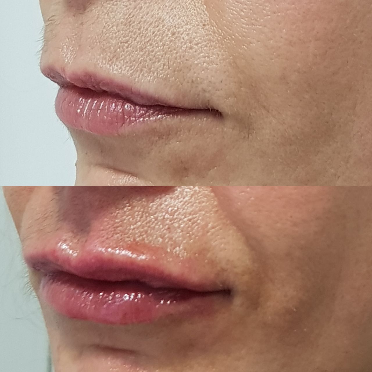 Rosalba Herrero Zerpa-276