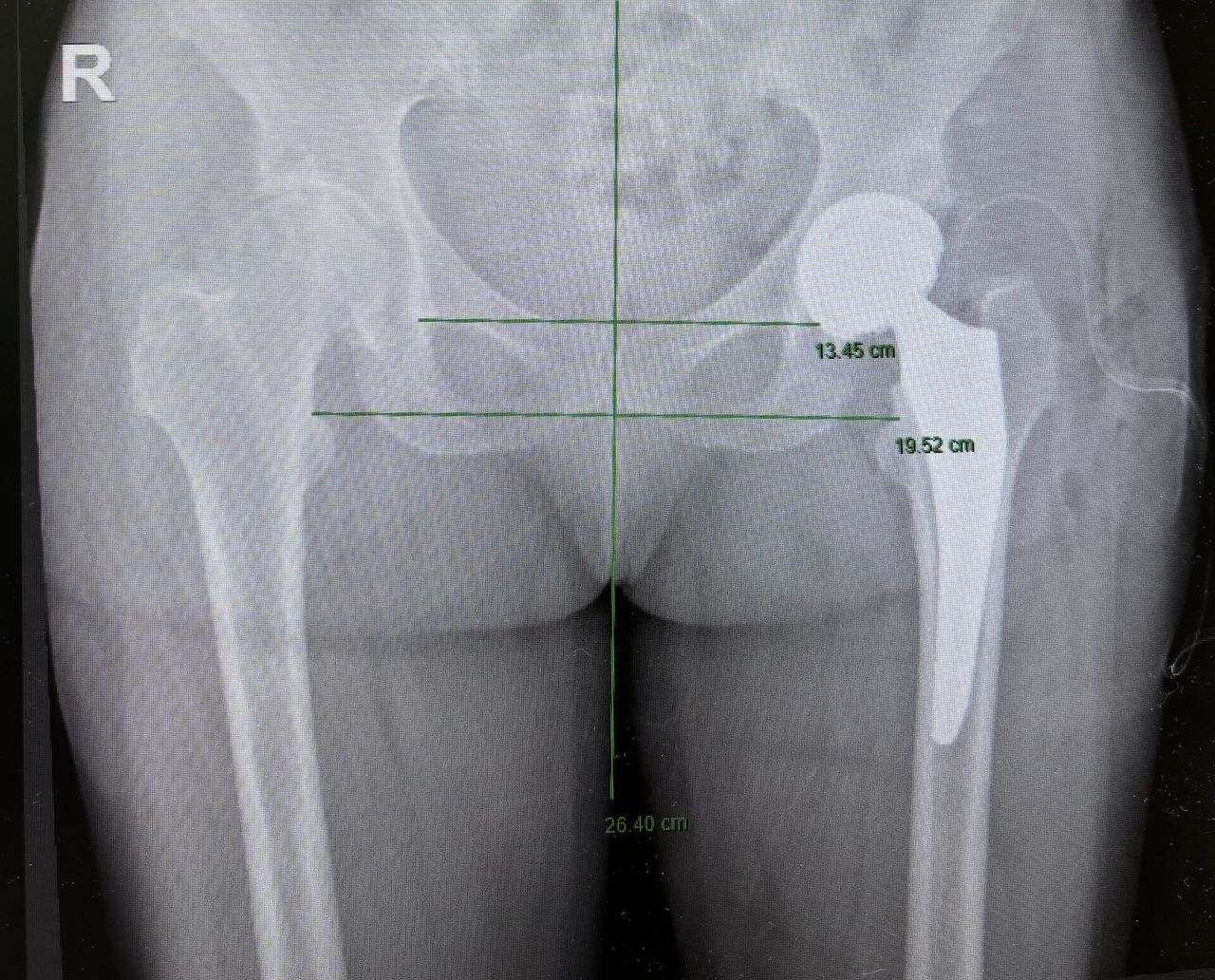 Alessandro Del Monaco-1