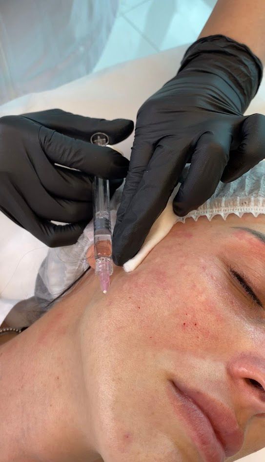 Yessica Corrales Acevedo-9