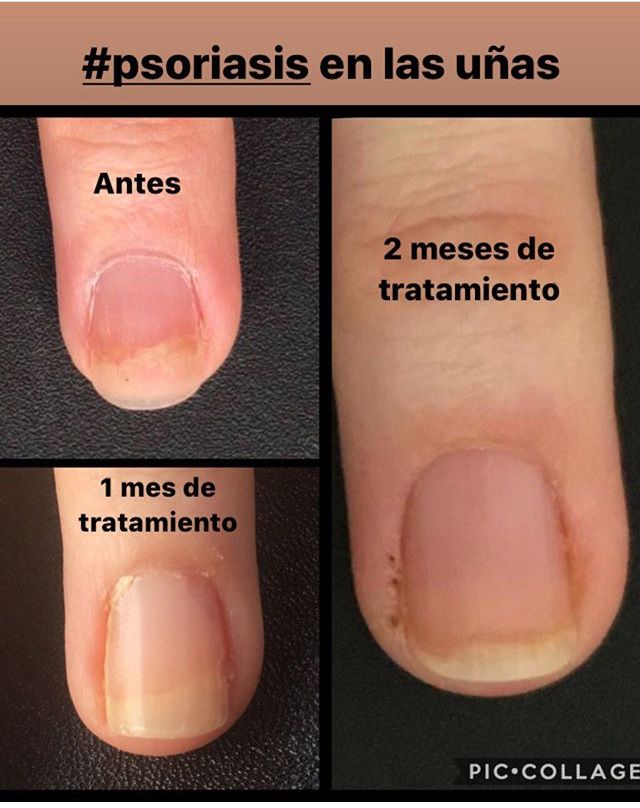 Olane Guergue Diaz De Cerio-31