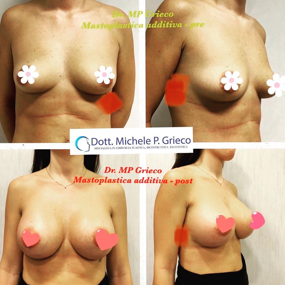 Michele P. Grieco-17