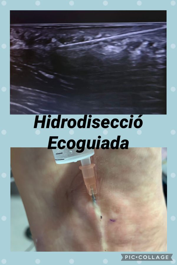 Mercè Garcia Lizandra-19