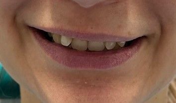 Riunito Dentista Dentalpar-12