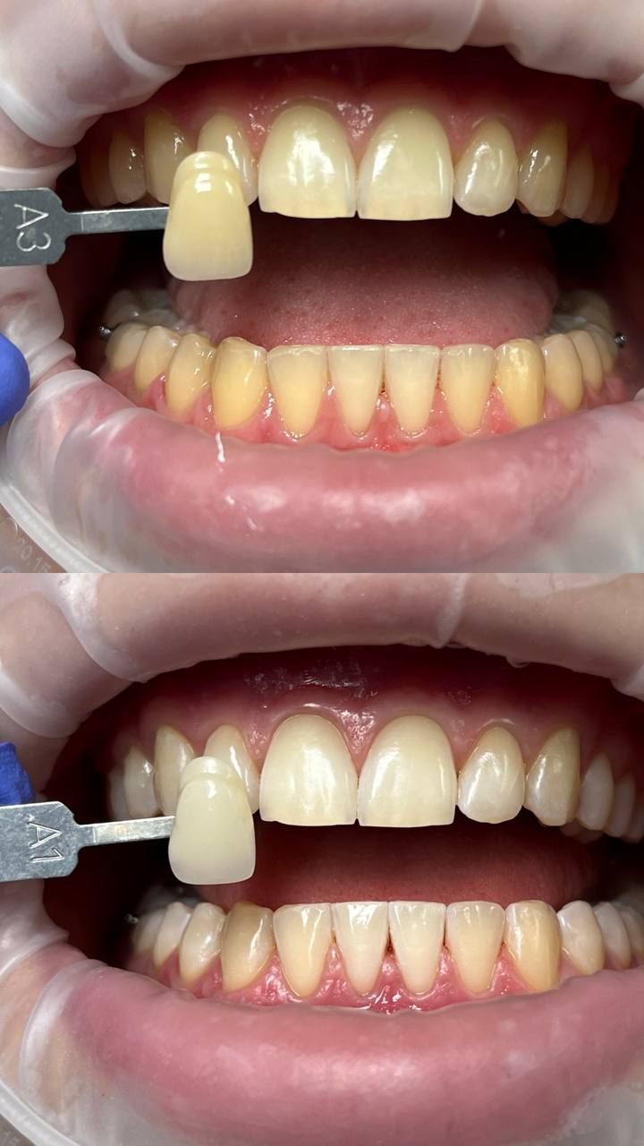 Tetiana Starodubets-2