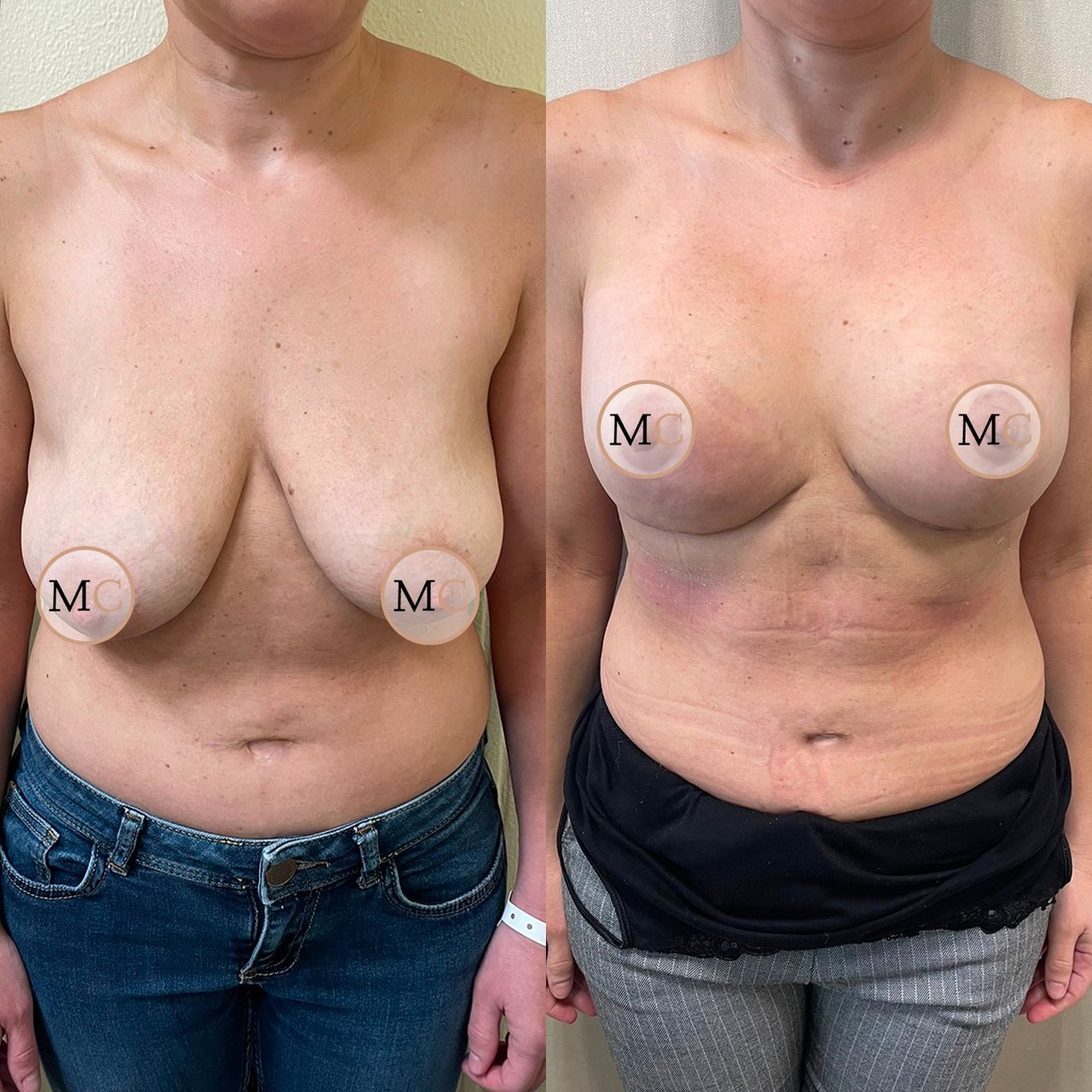 Marco Carmisciano-10