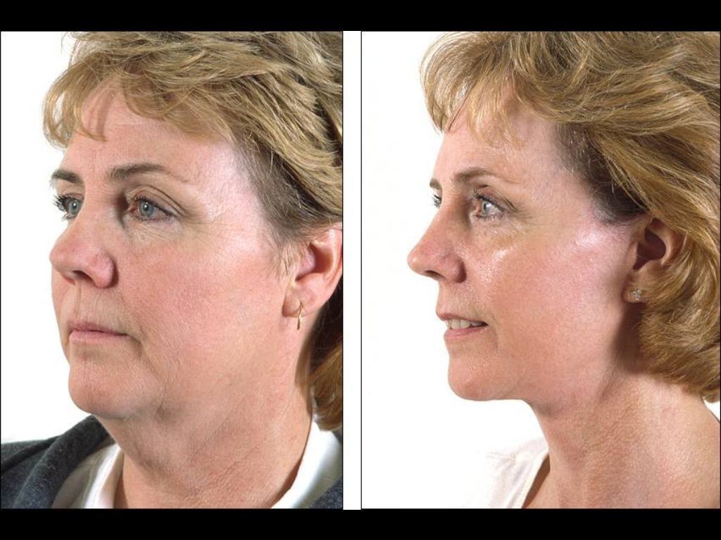 César Recalde Losada-15