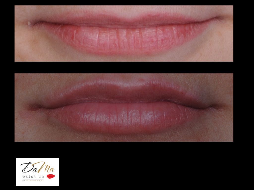 Dagmara Lisiak - Osuch-1