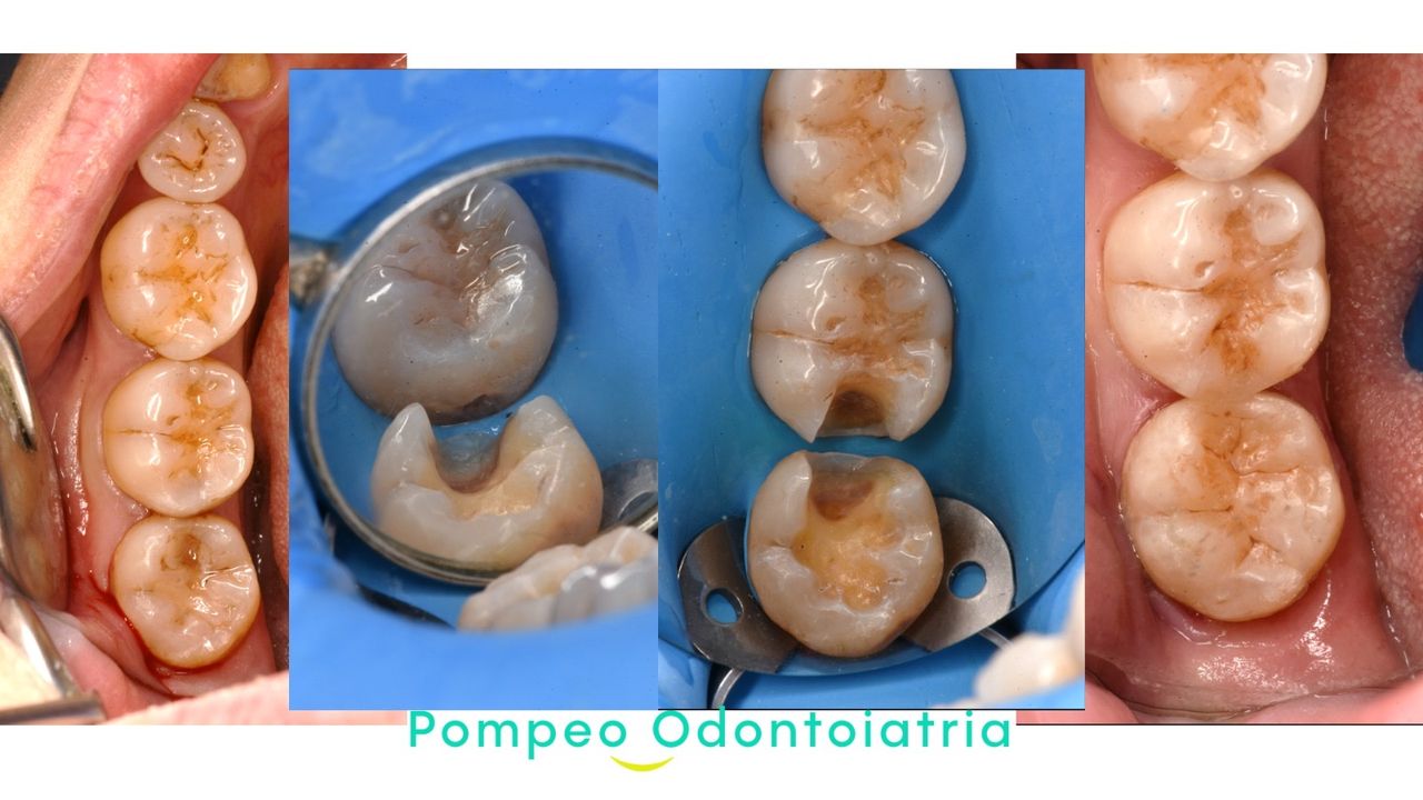 Enrico Maria Pompeo-11