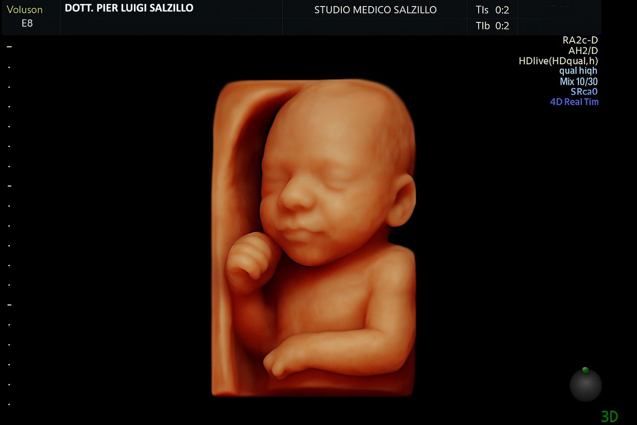 Pier Luigi Salzillo-7