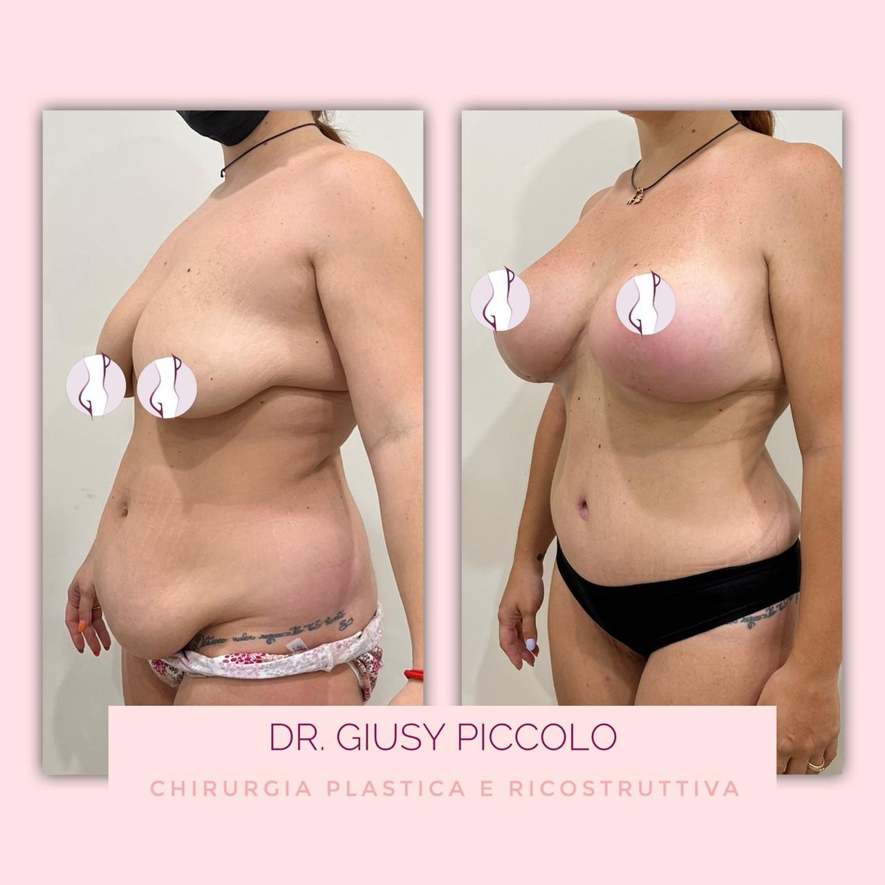 Giuseppina Piccolo-21