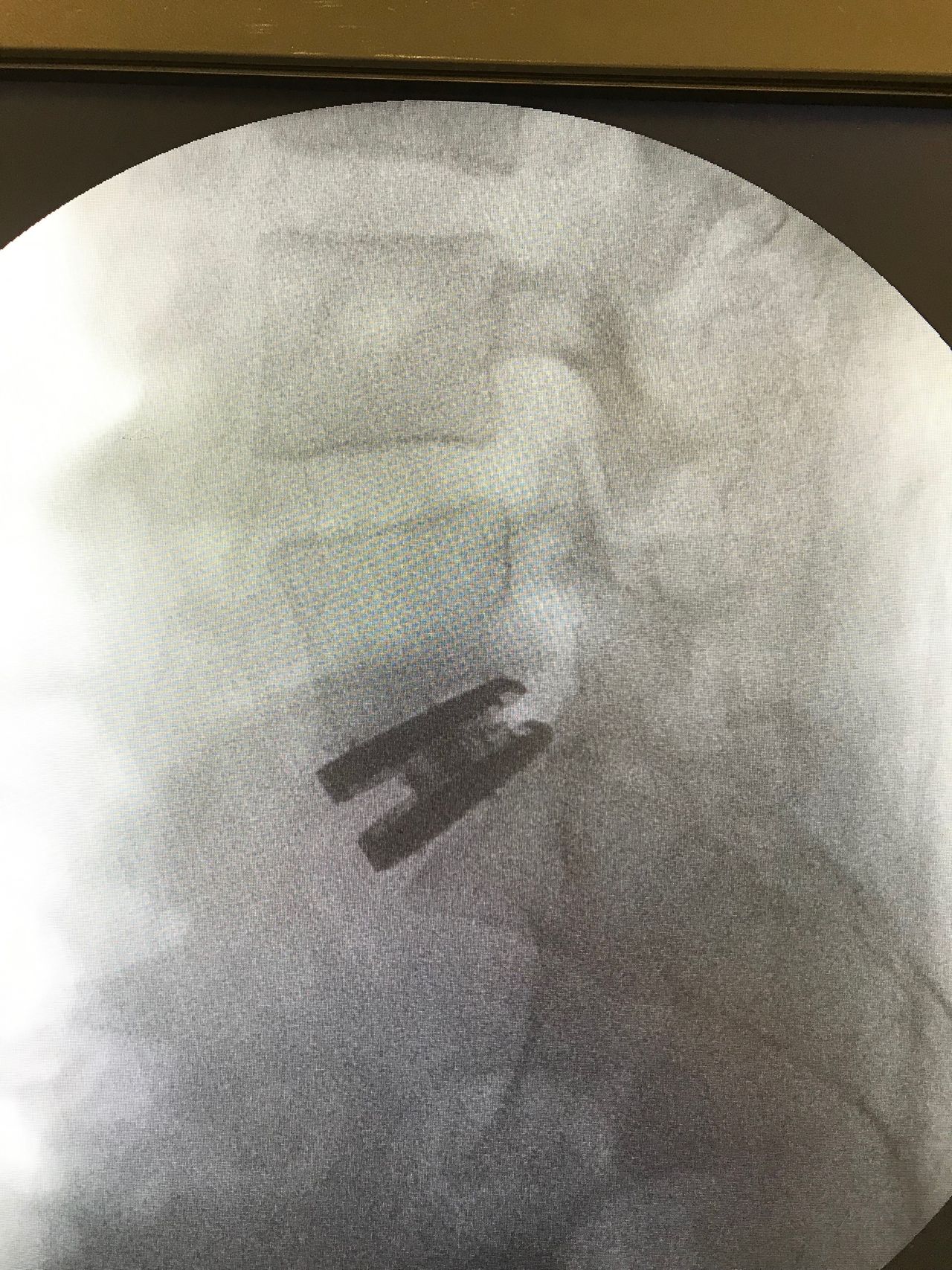 Juan Camilo Hernandez Acevedo-24