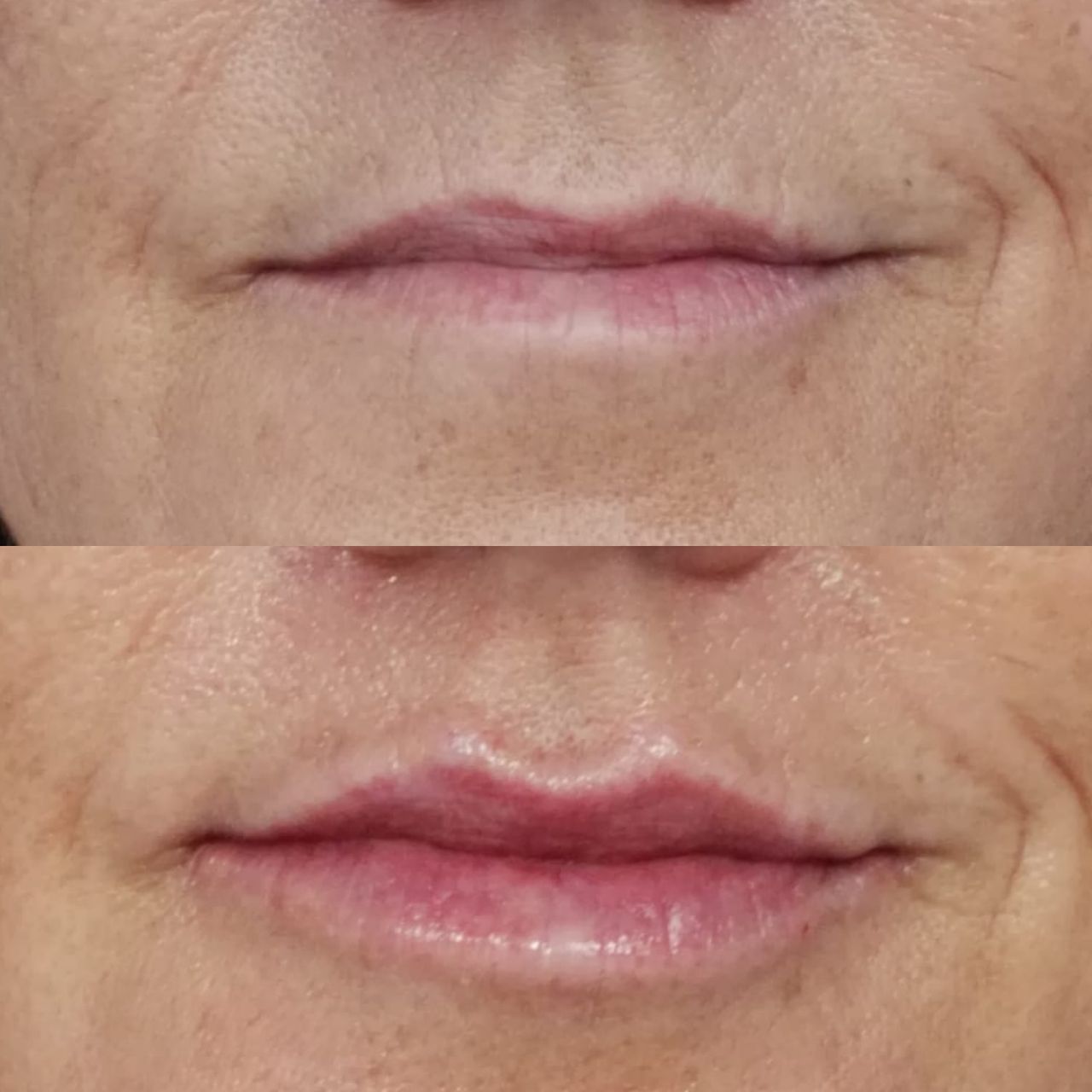 Rosalba Herrero Zerpa-233