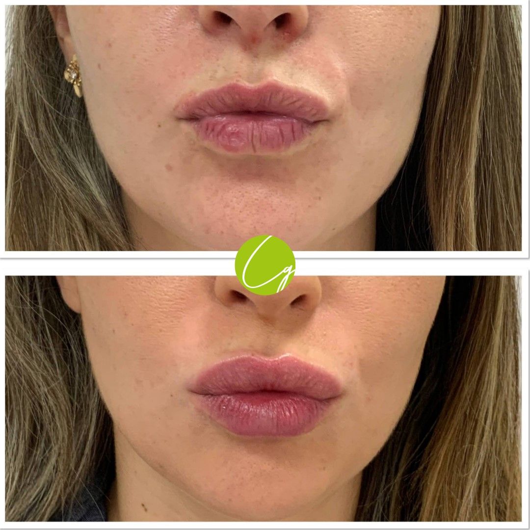 Raquel Gómez García-6