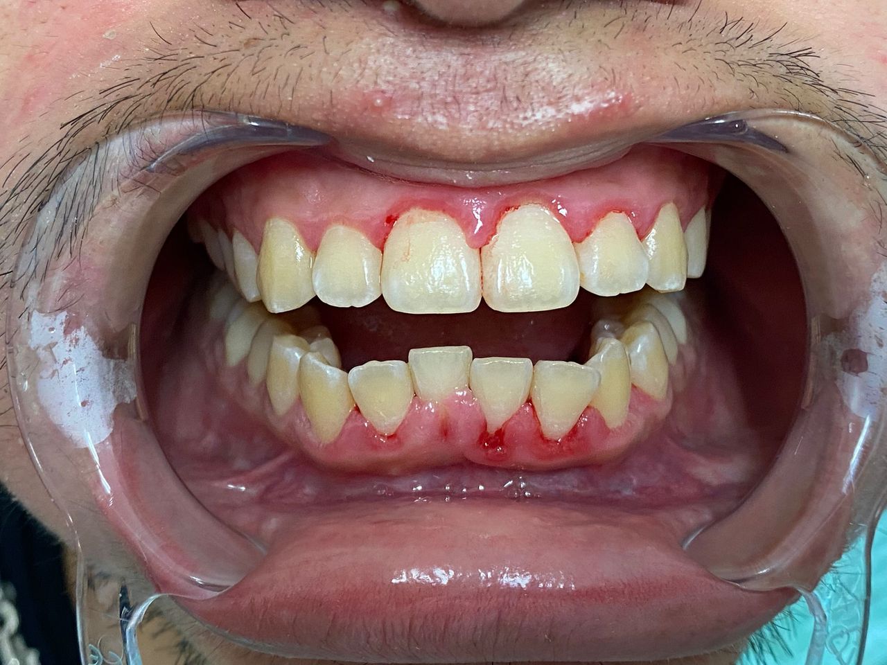 Riunito Dentista Dentalpar-18