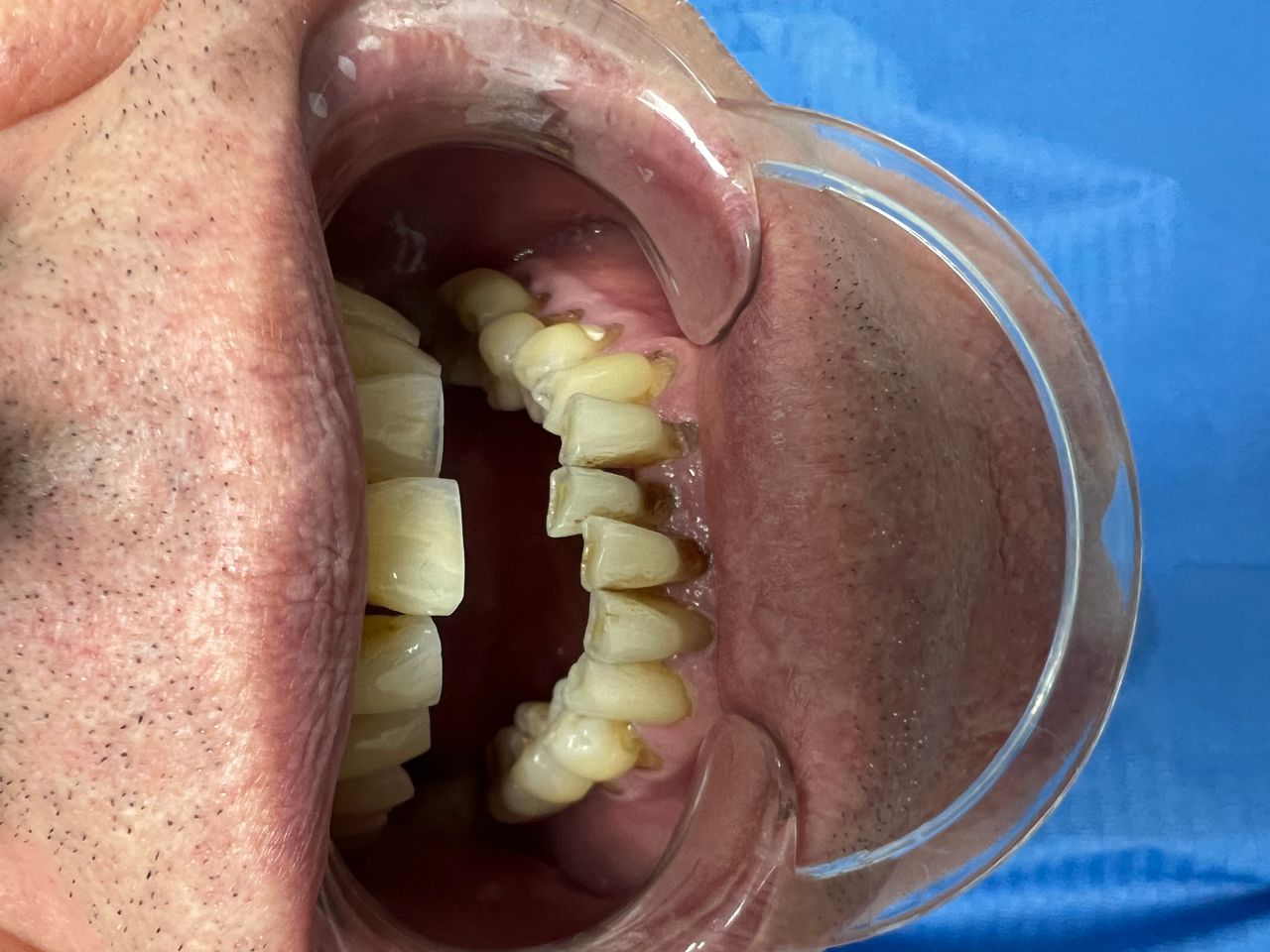 Luigi Aiardo Esposito-10