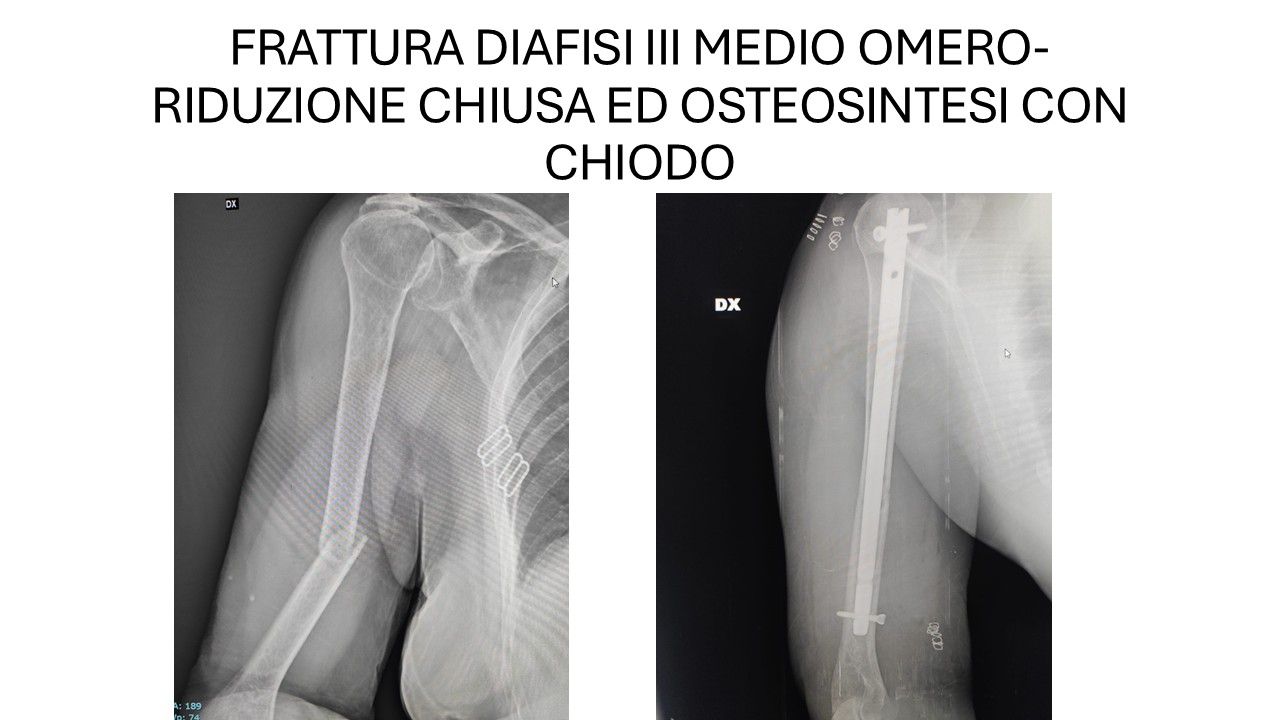 Bartolomeo D'amora-15