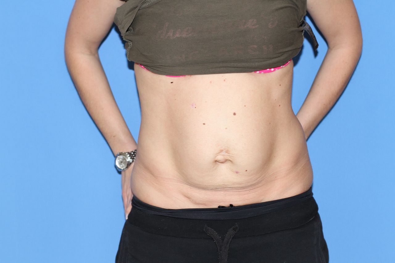 Maciej Charaziński-140