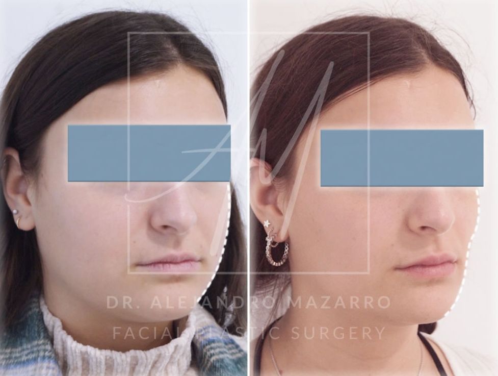 Alejandro Mazarro Campos-6