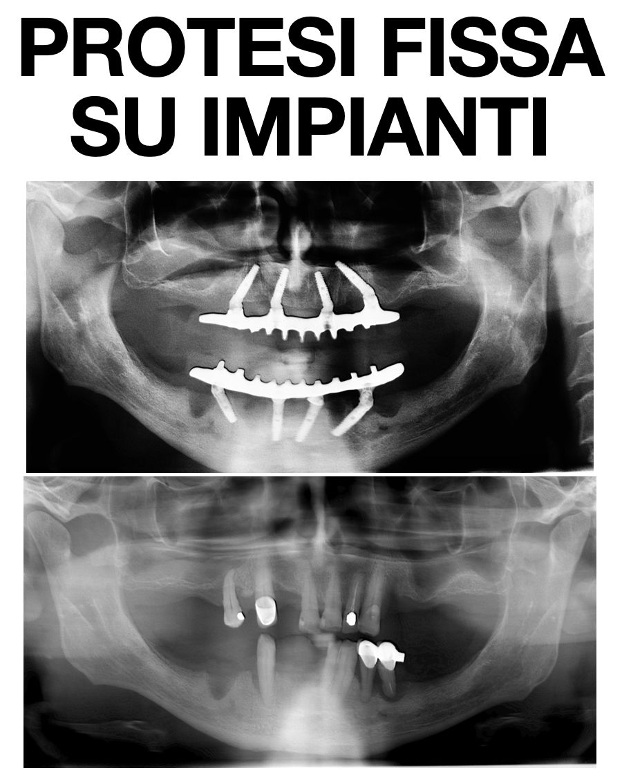 Riccardo Michelotto Tempesta-5