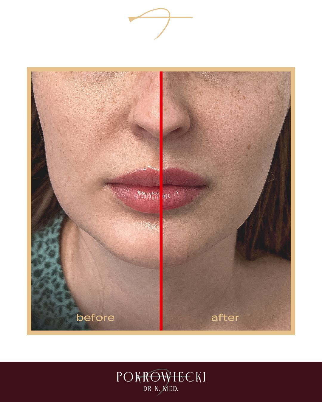 Rafał Pokrowiecki-28