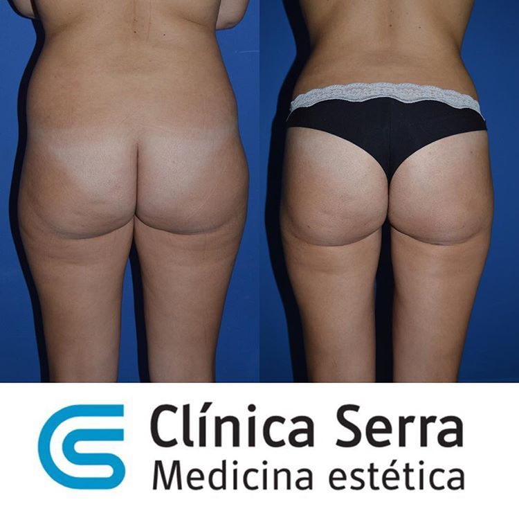 José Maria Serra Mestre-7