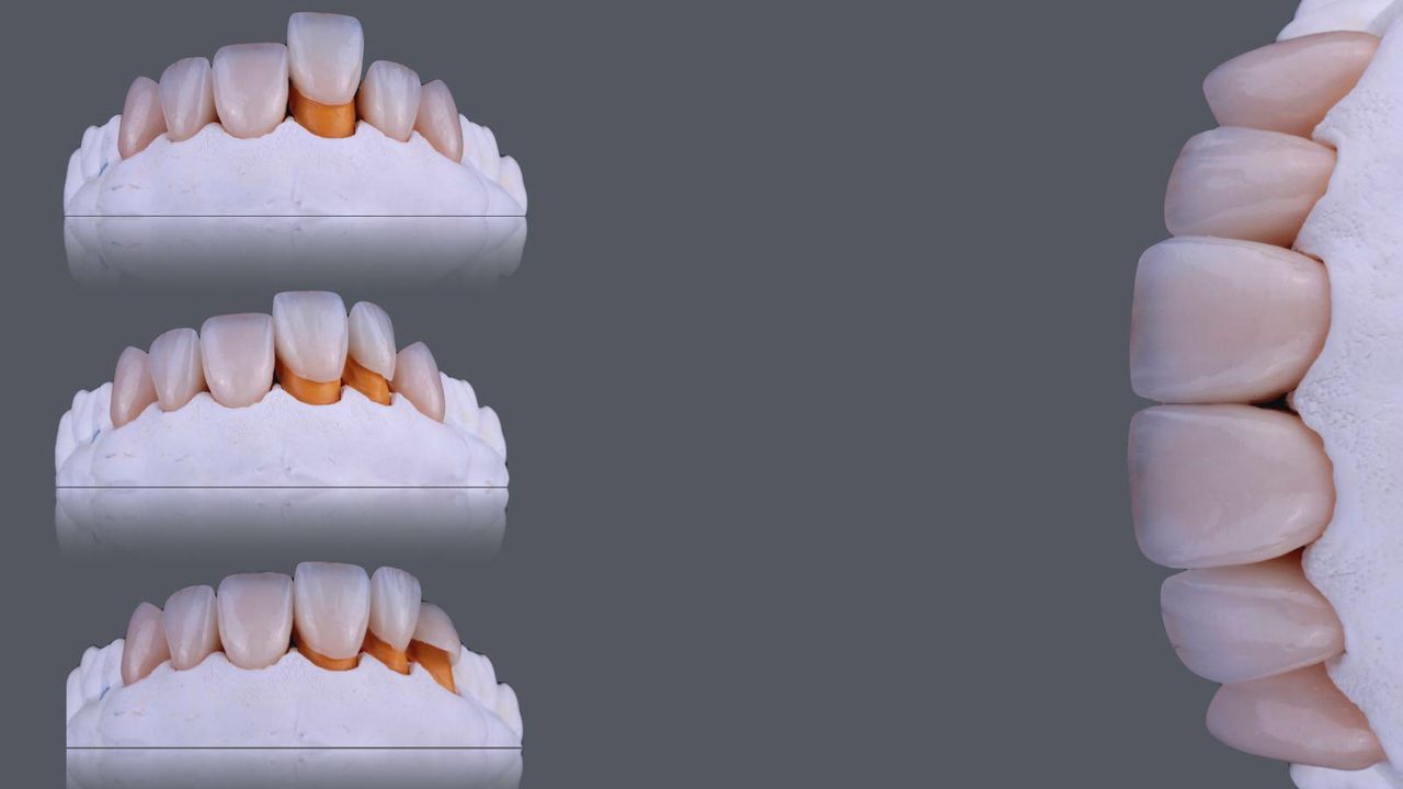 Gonzalo Navarro Boto-7