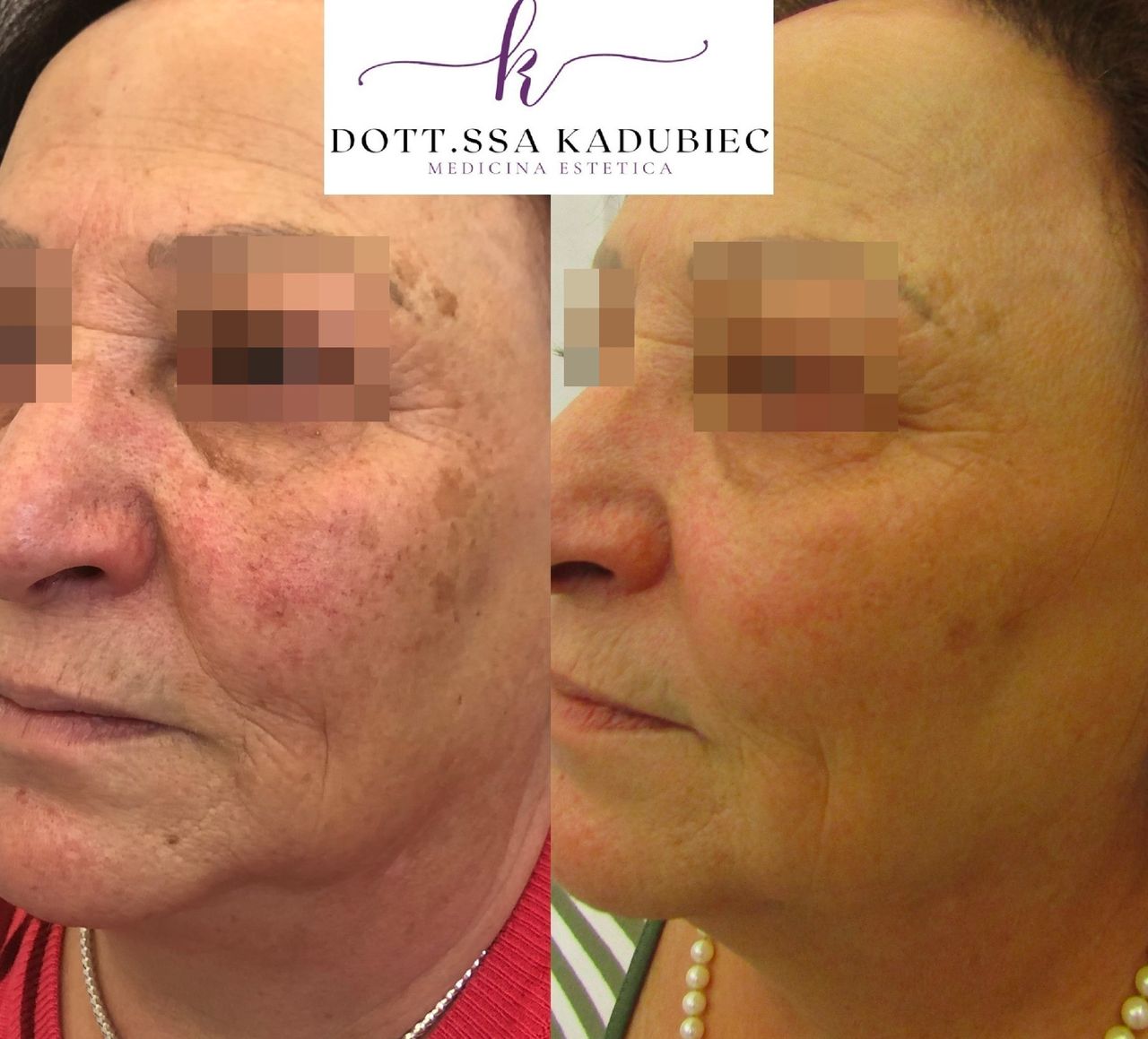 Aleksandra Kadubiec-25