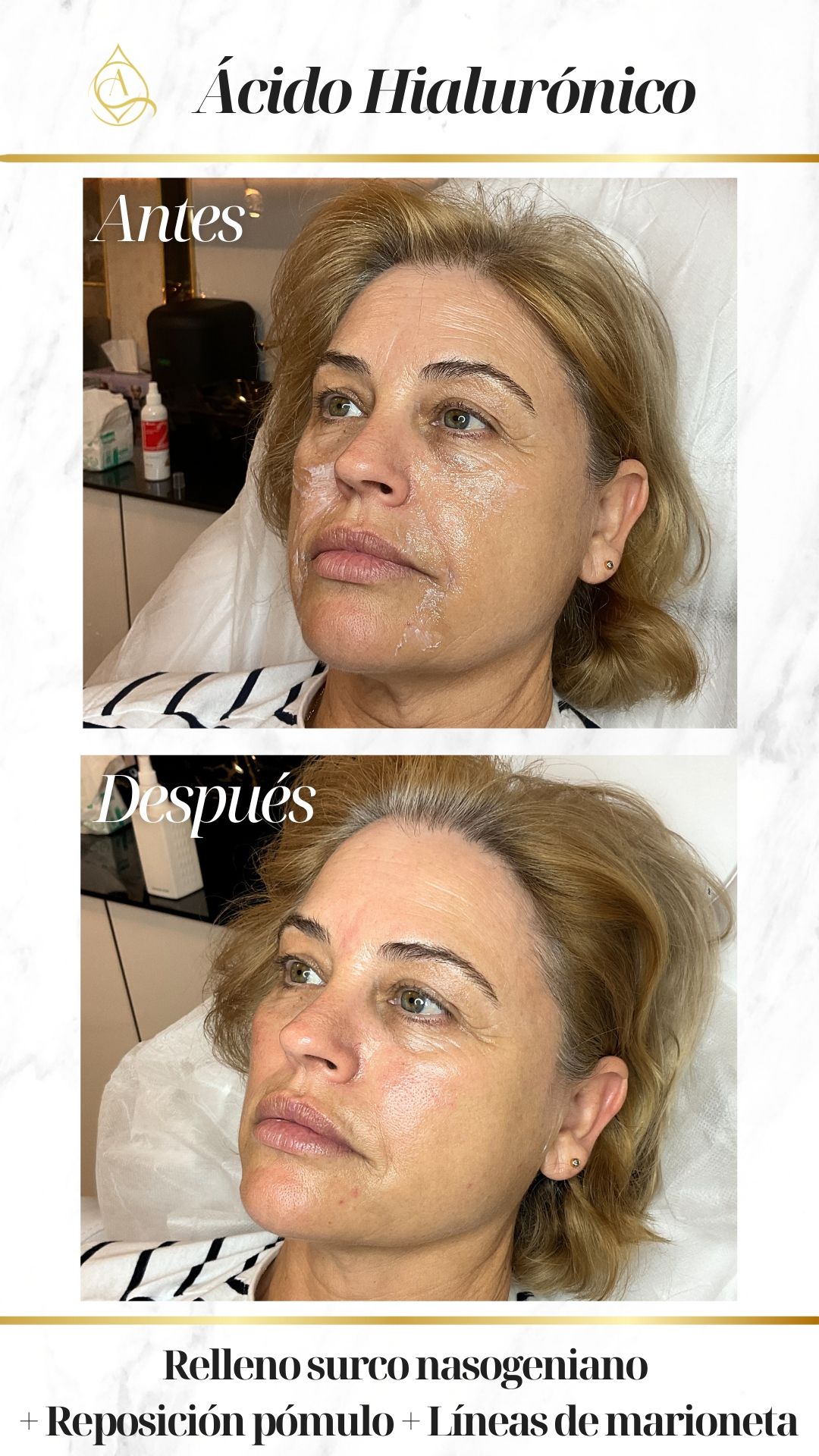 Adriana García Costa-7