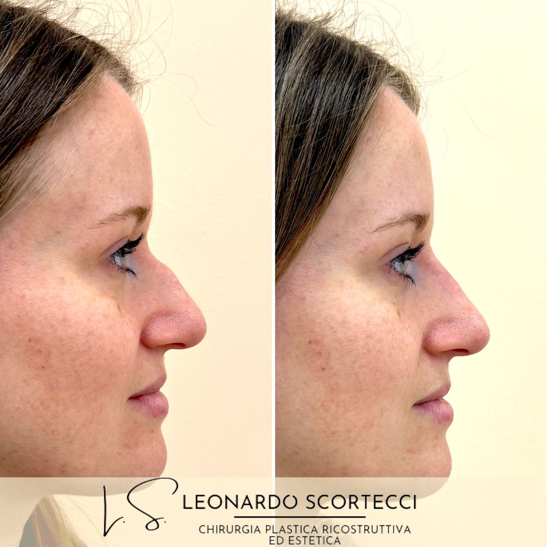 Leonardo Scortecci-18