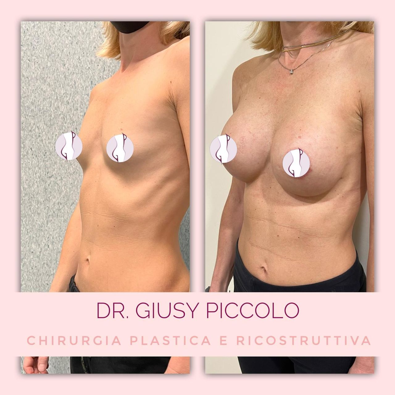 Giuseppina Piccolo-25