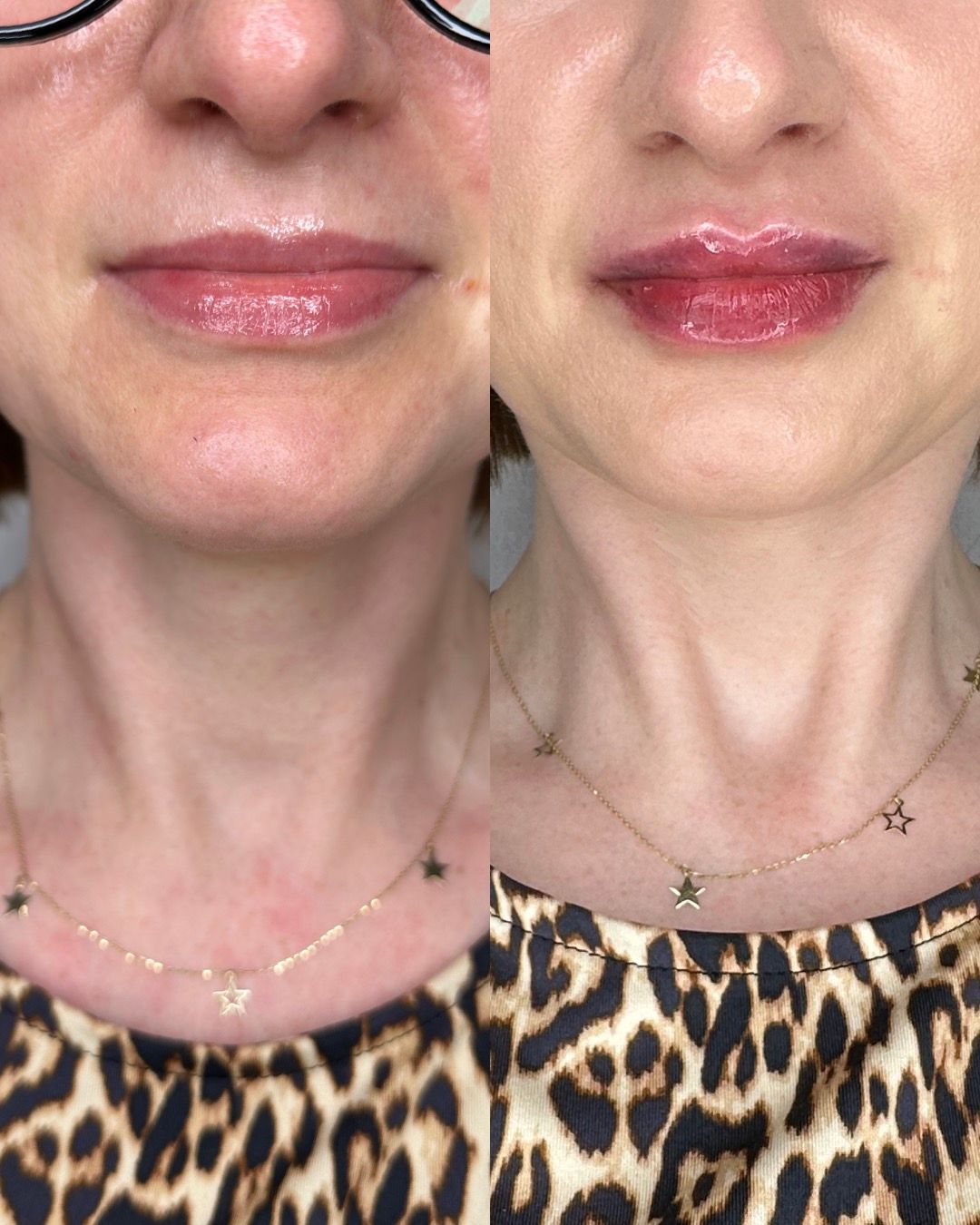 Michalina Zagańczyk-Bączek-46