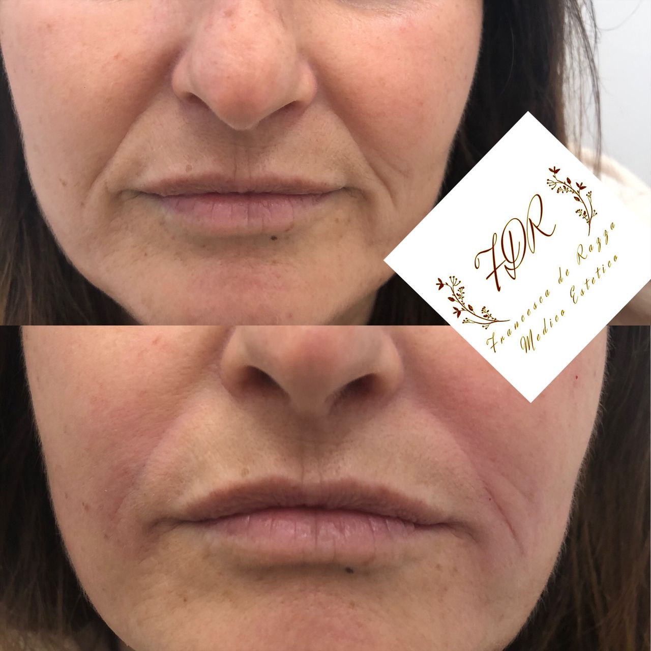 Francesca De Razza-44