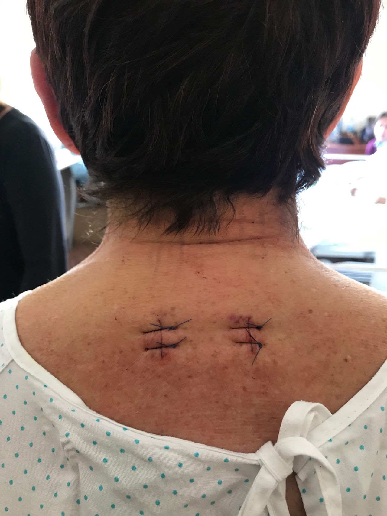 Juan Camilo Hernandez Acevedo-31