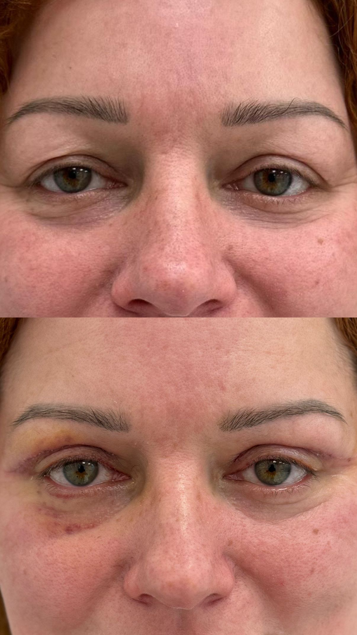 Katarzyna Kowalczyk-4