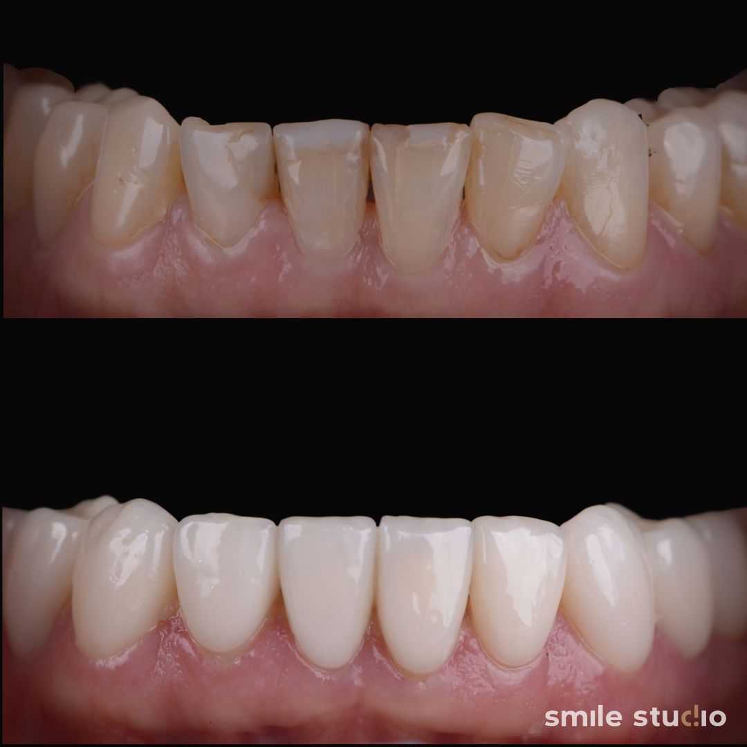 Michał Jankowski-18