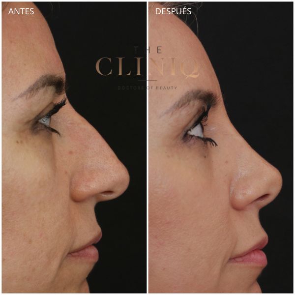 Ricardo Coronel Gagliardi-4