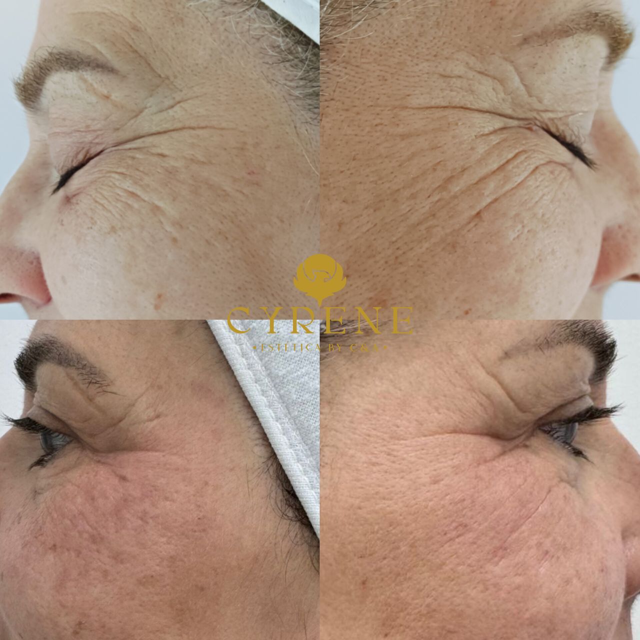 Yolimar Acevedo Raya-0