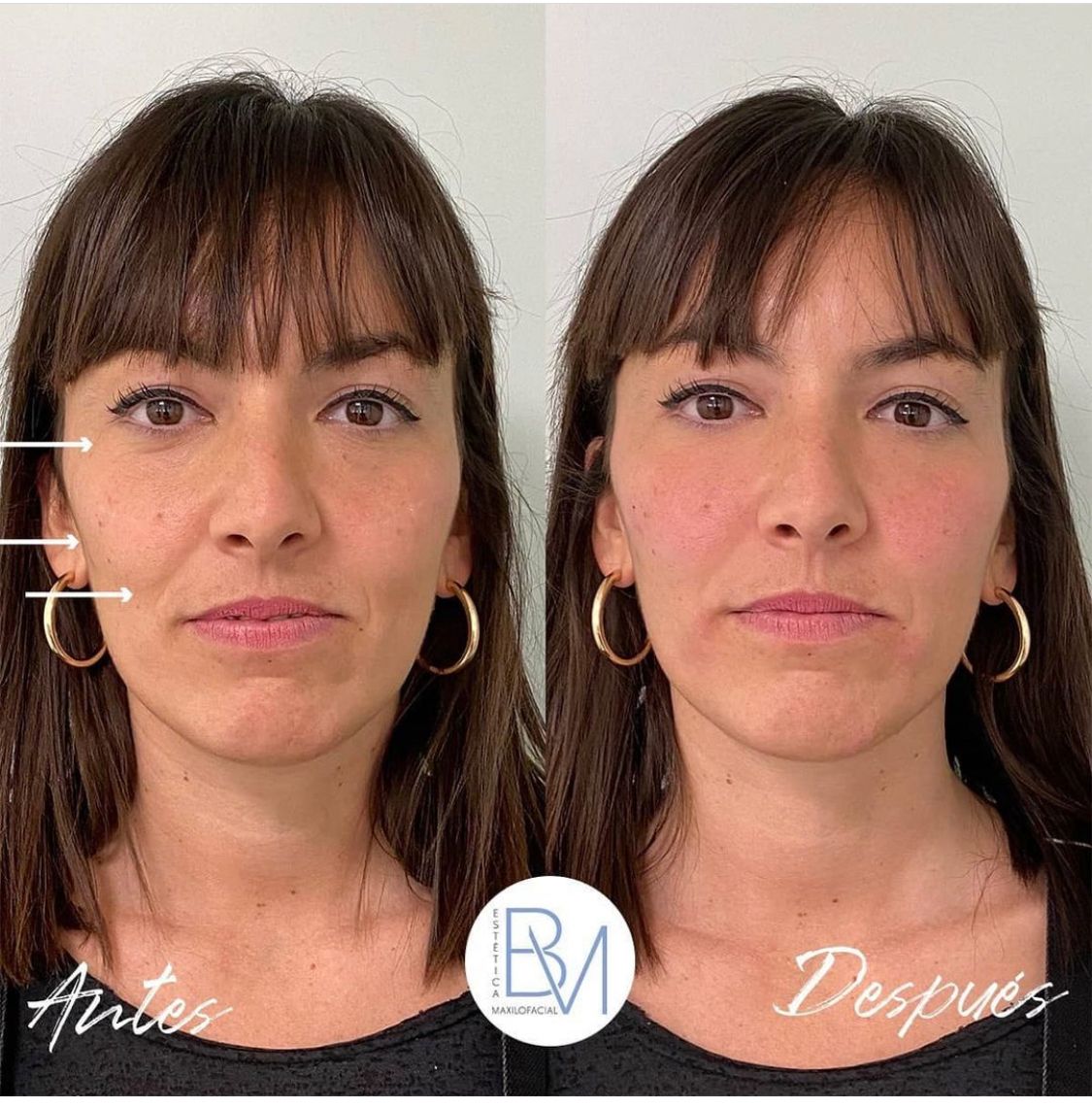 Beatriz Moralejo-118