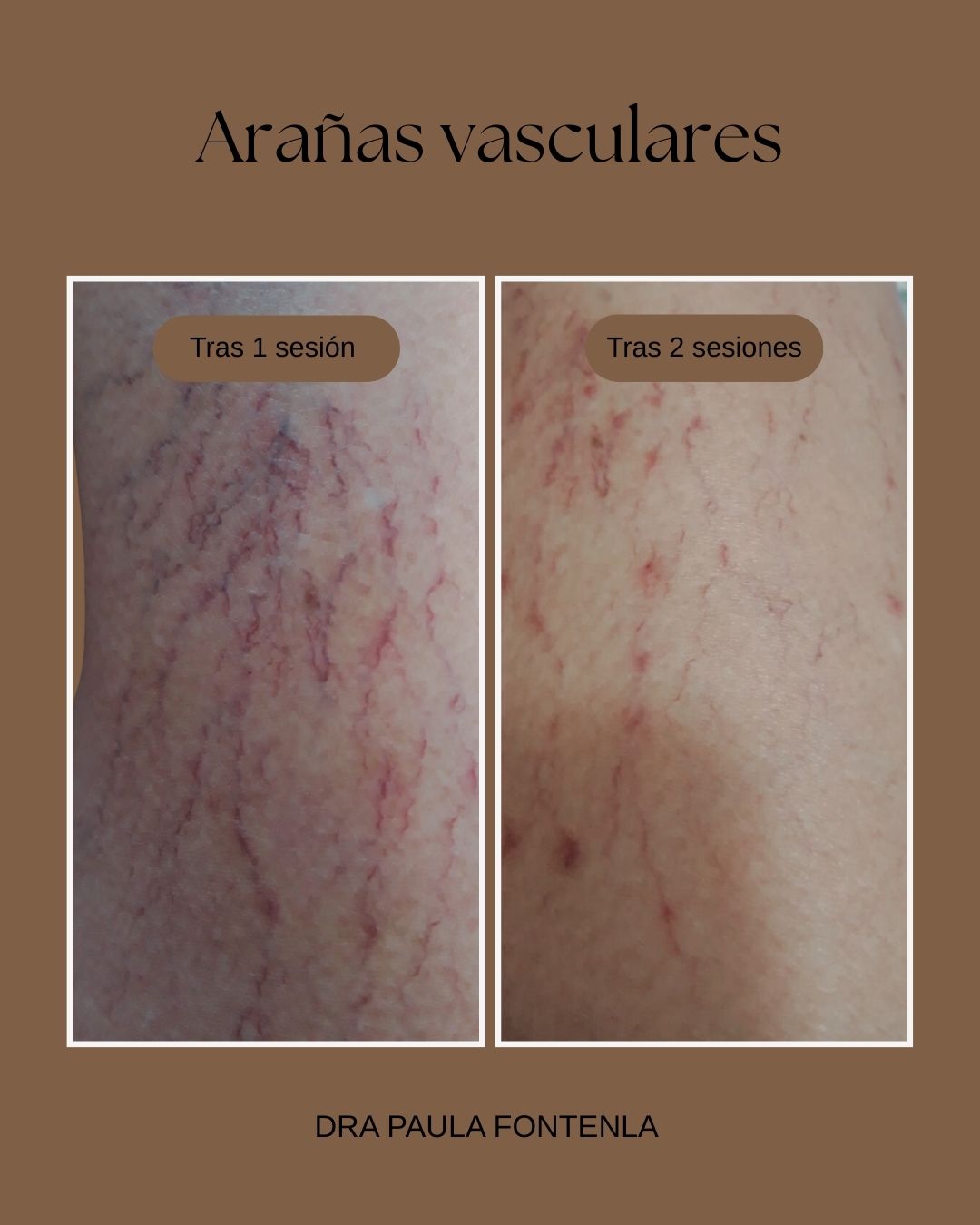 Paula Fontenla Seco-11