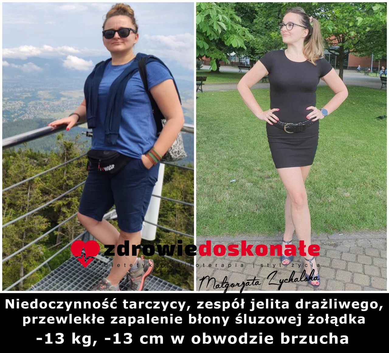 Małgorzata Zychalska-61