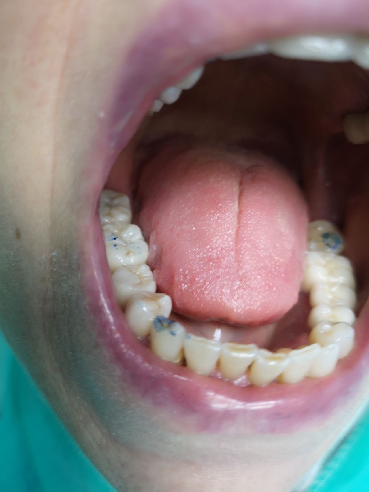 Stefano De Simone-80