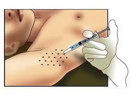 Rosalba Herrero Zerpa-405