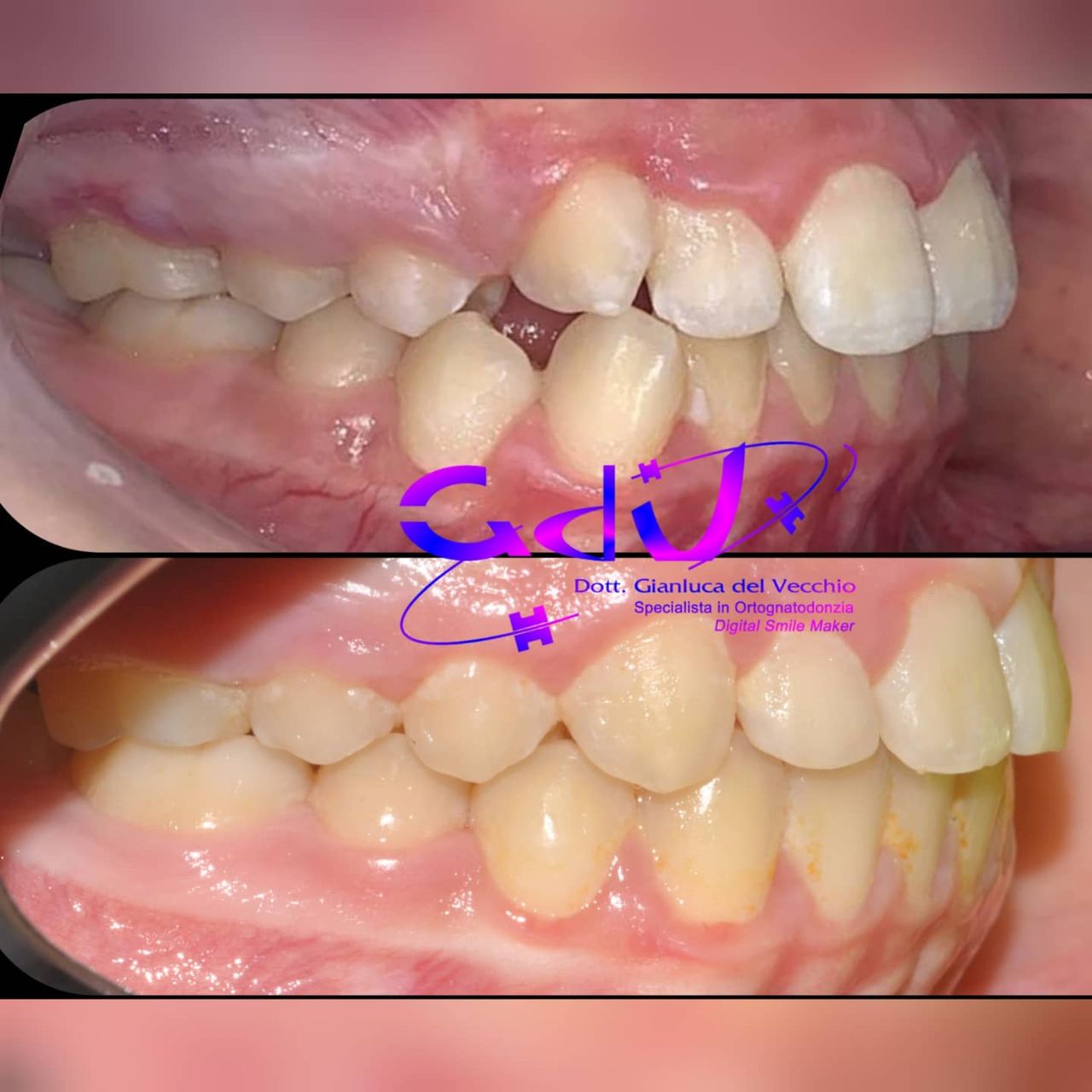 Gianluca Del Vecchio-122