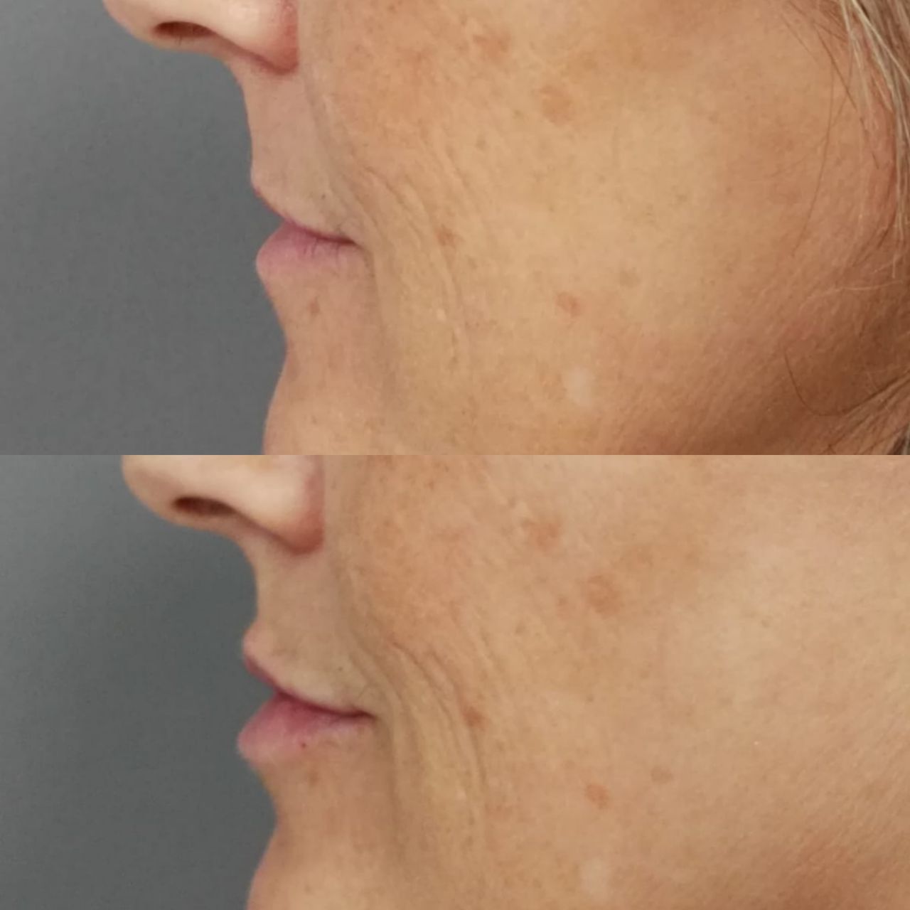 Rosalba Herrero Zerpa-234