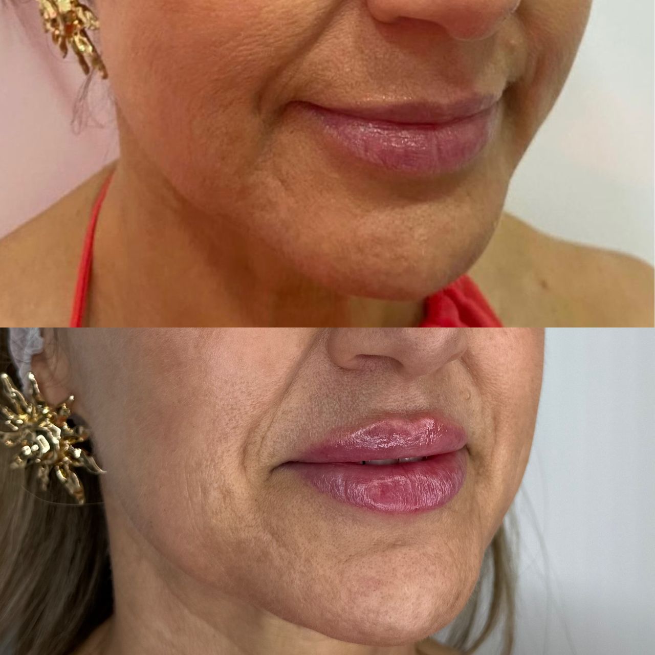 Raffaele Del Prete-3