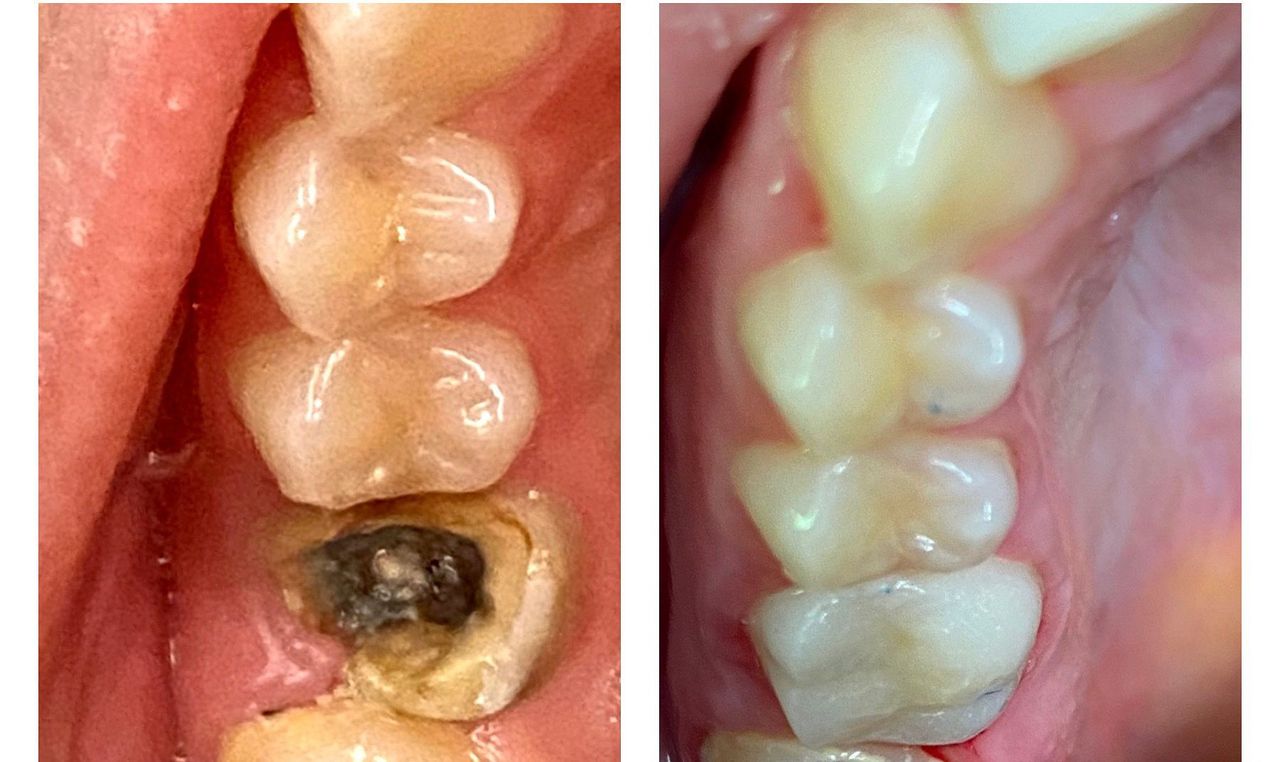 Federica Del Villano-4